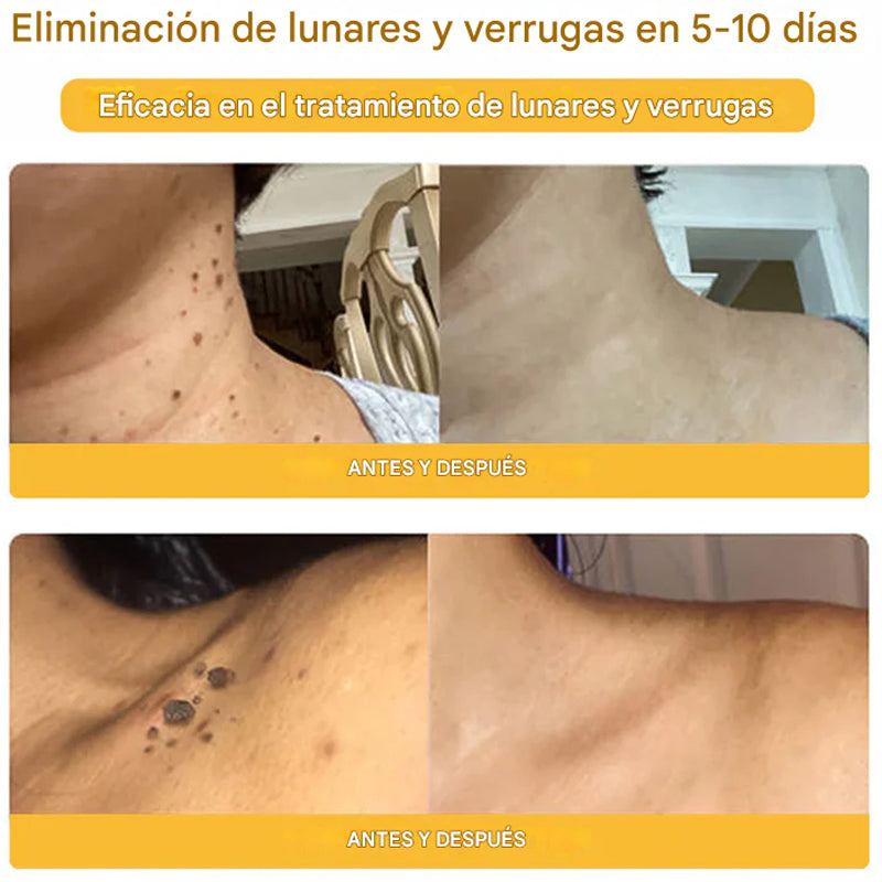 Crema para la piel con veneno de abeja