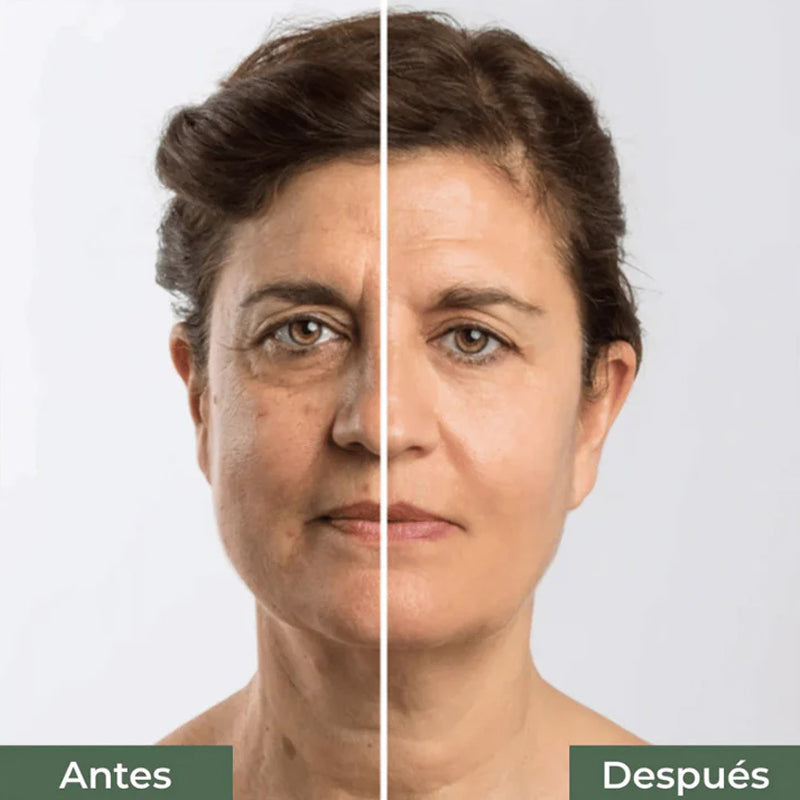 Elixir Antiarrugas® Rejuvenecimiento Total 3X 💎