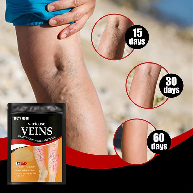 Parches para tratamiento de varices