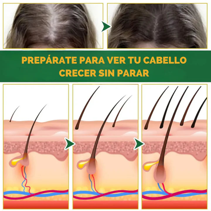 OUHOE - SUERO PARA EL CRECIMIENTO DE CABELLO