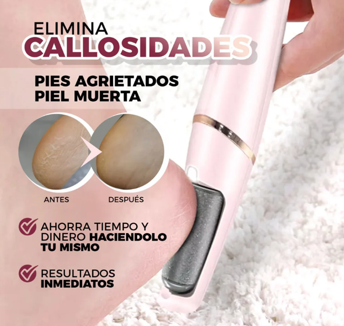 SmoothPro™ - Removedor Eléctrico De Callos