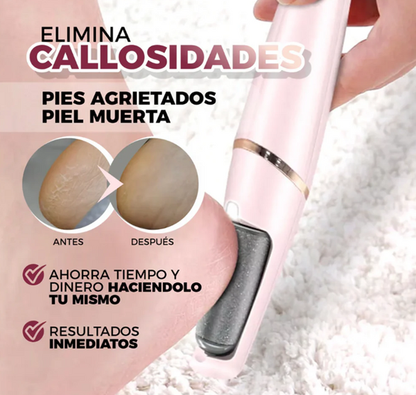 SmoothPro™ - Removedor Eléctrico De Callos